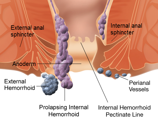 Beverly Hills colonoscopy